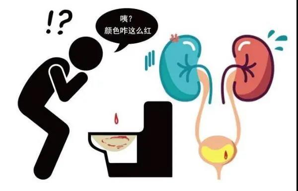 韶关结石医院，韶关正规结石医院，韶关结石医院哪家好